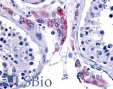 ESRRB / ERR Beta Antibody - Anti-ESRRB antibody IHC of human testis. Immunohistochemistry of formalin-fixed, paraffin-embedded tissue after heat-induced antigen retrieval.