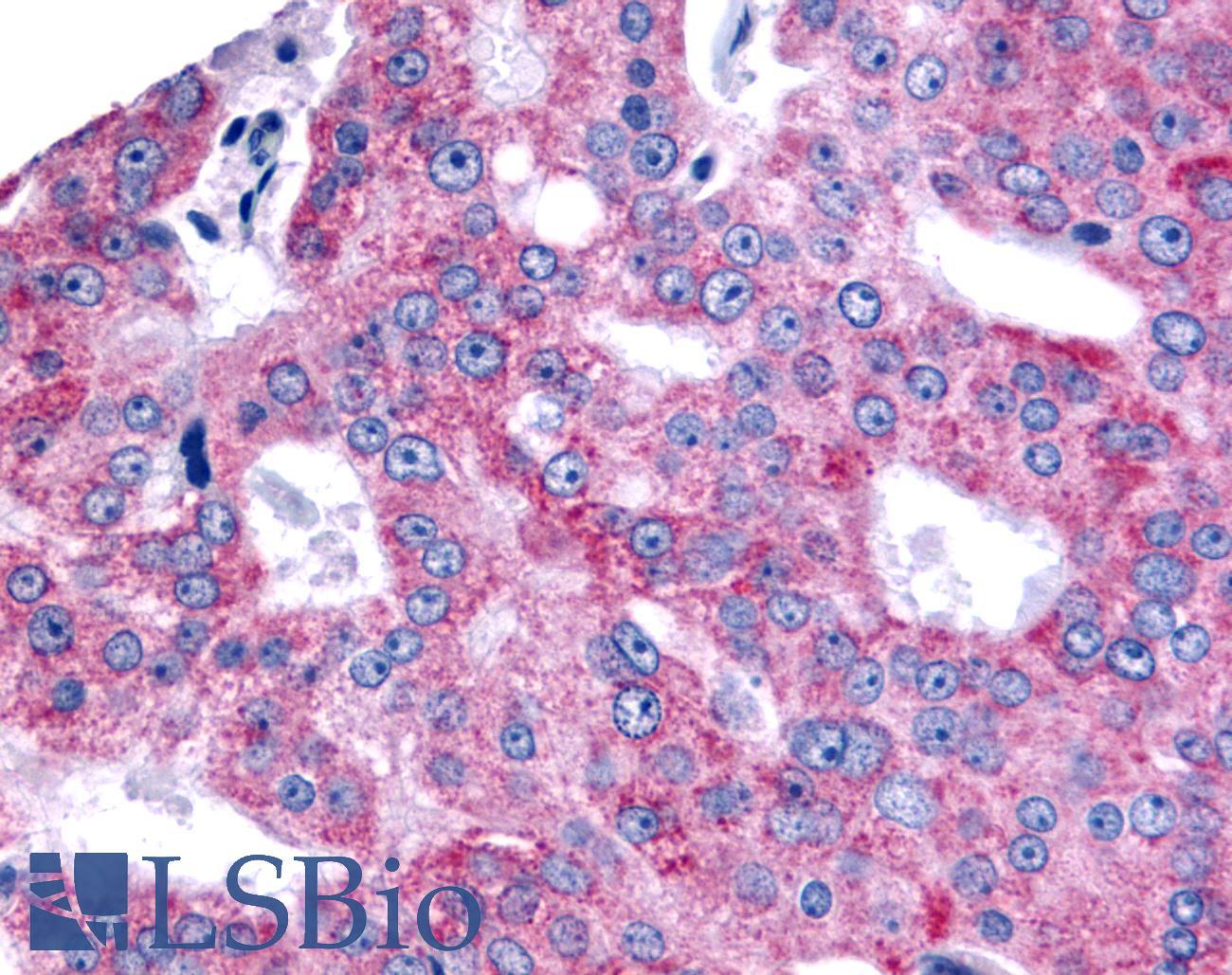 ESRRB / ERR Beta Antibody - Prostate, Carcinoma