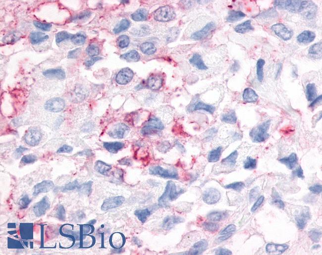 ESRRG / ERR Gamma Antibody - Breast carcinoma