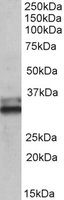ETFA Antibody - ETFA antibody (0.1 ug/ml) staining of Human Colon lysate (35 ug protein/ml in RIPA buffer). Primary incubation was 1 hour. Detected by chemiluminescence.