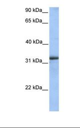 ETFA Antibody - Human Fetal heart lysate. Antibody concentration: 1.0 ug/ml. Gel concentration: 12%.  This image was taken for the unconjugated form of this product. Other forms have not been tested.
