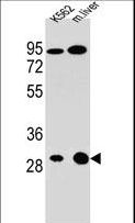 ETFA Antibody - ETFA Antibody western blot of K562 cell line and mouse liver tissue lysates (35 ug/lane). The ETFA antibody detected the ETFA protein (arrow).
