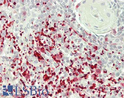 F13A1 / Factor XIIIa Antibody - Human Spleen: Formalin-Fixed, Paraffin-Embedded (FFPE)