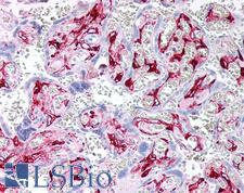 F13A1 / Factor XIIIa Antibody - Human Placenta: Formalin-Fixed, Paraffin-Embedded (FFPE)