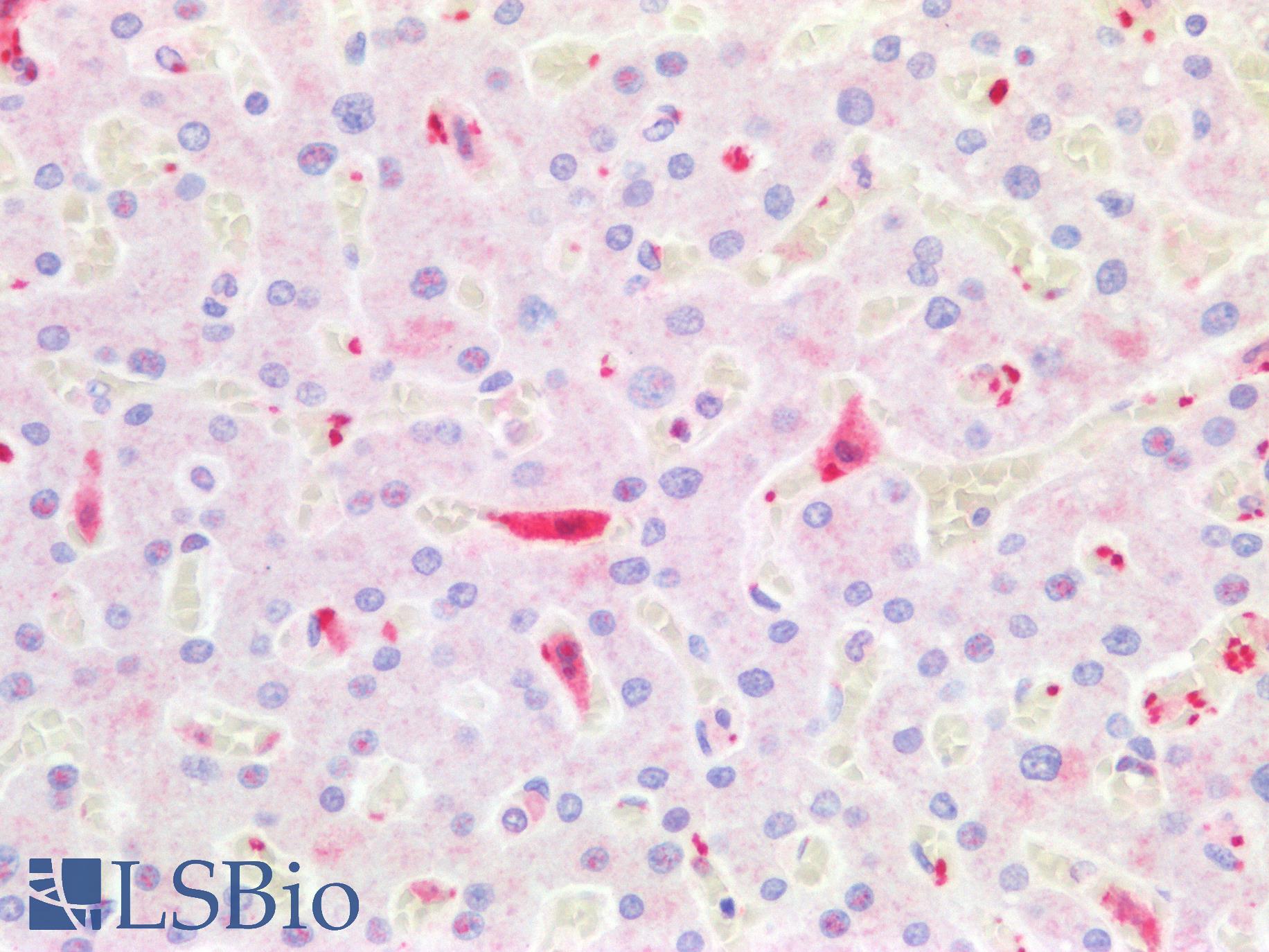 F13A1 / Factor XIIIa Antibody - Human Liver, Kupffer Cells: Formalin-Fixed, Paraffin-Embedded (FFPE)