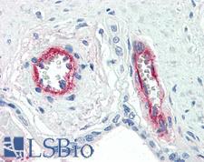 F8 / FVIII / Factor VIII Antibody - Anti-F8 / Factor VIII antibody IHC of human placenta, vessels. Immunohistochemistry of formalin-fixed, paraffin-embedded tissue after heat-induced antigen retrieval. Antibody concentration 10 ug/ml.