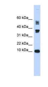 FABP3 / H-FABP Antibody - FABP3 antibody Western blot of Fetal Heart lysate. This image was taken for the unconjugated form of this product. Other forms have not been tested.