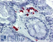FASLG / Fas Ligand Antibody - Anti-FASLG / FASL antibody IHC of human colon. Immunohistochemistry of formalin-fixed, paraffin-embedded tissue after heat-induced antigen retrieval. Antibody concentration 10 ug/ml.