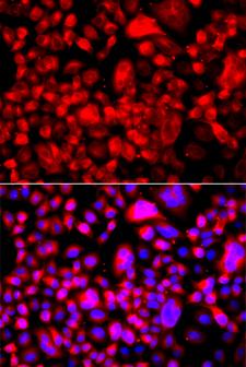 FASN / Fatty Acid Synthase Antibody - Immunofluorescence analysis of A549 cells using FASN antibody. Blue: DAPI for nuclear staining.