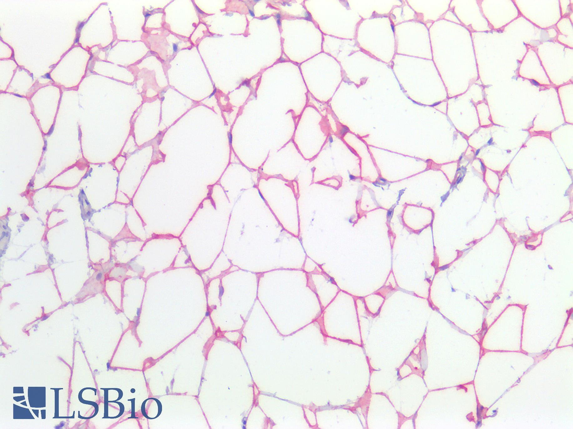 FASN / Fatty Acid Synthase Antibody - Human Breast, Adipocytes: Formalin-Fixed, Paraffin-Embedded (FFPE)