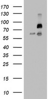 FBXW7 / FBW7 Antibody - HEK293T cells were transfected with the pCMV6-ENTRY control (Left lane) or pCMV6-ENTRY FBXW7 (Right lane) cDNA for 48 hrs and lysed. Equivalent amounts of cell lysates (5 ug per lane) were separated by SDS-PAGE and immunoblotted with anti-FBXW7.