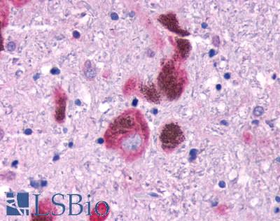 FFAR1 / GPR40 Antibody - Brain, Parkinson's Disease 