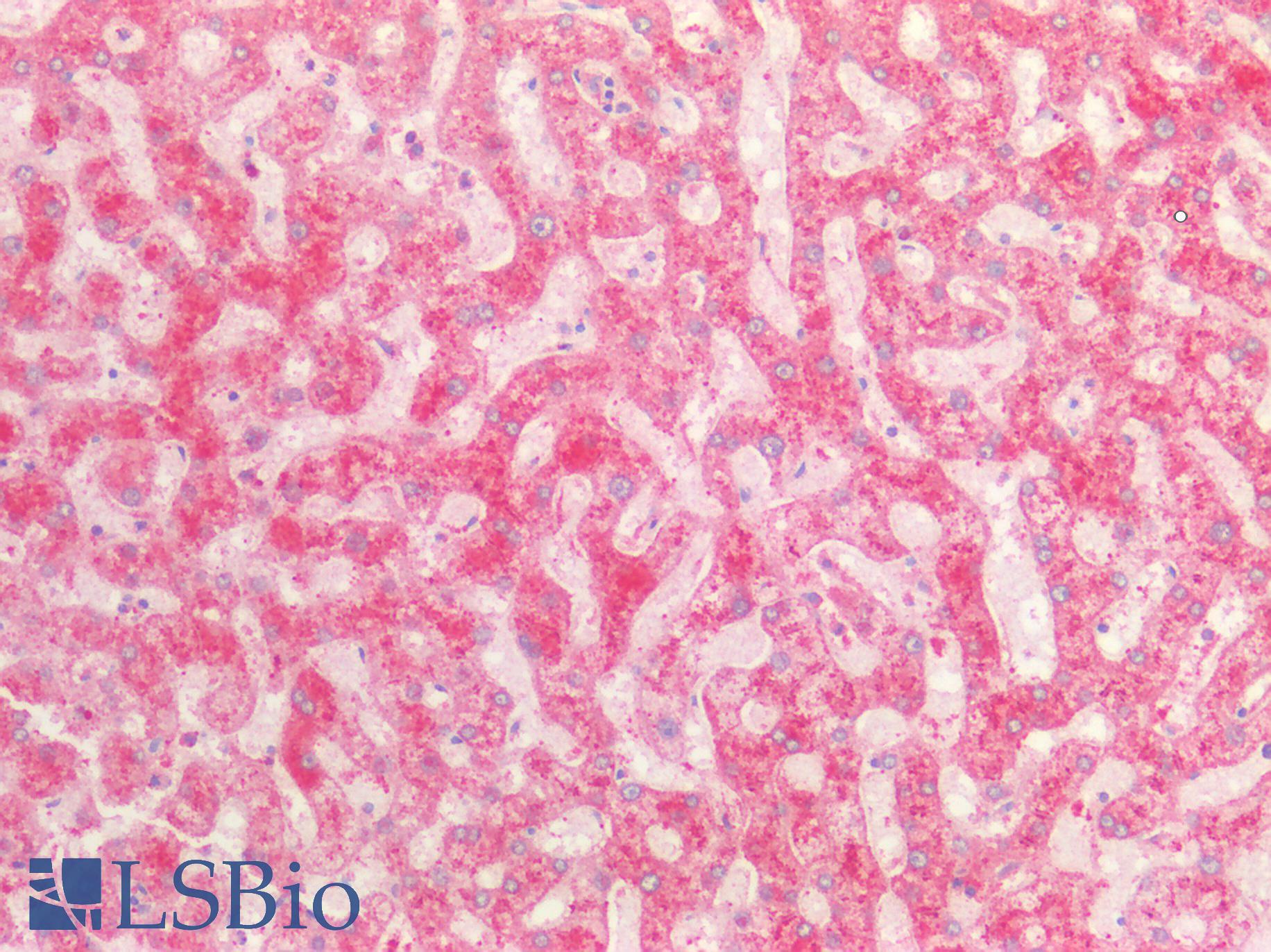 FGA / Fibrinogen Alpha Antibody - Human Liver: Formalin-Fixed, Paraffin-Embedded (FFPE)