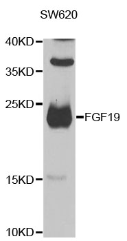 FGF19 Antibody - Western blot analysis of extracts of SW620 cells.