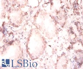 FGF2 / Basic FGF Antibody - Immunohistochemistry of paraffin-embedded human prostate using.  This image was taken for the unconjugated form of this product. Other forms have not been tested.