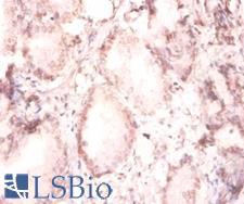 FGF2 / Basic FGF Antibody - Immunohistochemistry of paraffin-embedded human prostate using.  This image was taken for the unconjugated form of this product. Other forms have not been tested.