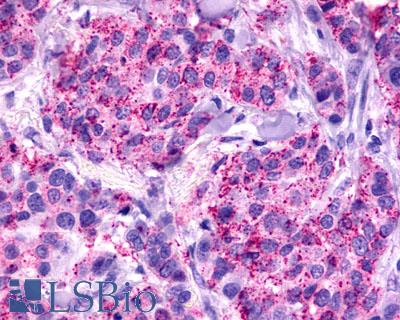FKSG80 / GPR81 Antibody - Breast, Carcinoma