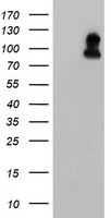 FOLH1 / PSMA Antibody - HEK293T cells were transfected with the pCMV6-ENTRY control (Left lane) or pCMV6-ENTRY FOLH1 (Right lane) cDNA for 48 hrs and lysed. Equivalent amounts of cell lysates (5 ug per lane) were separated by SDS-PAGE and immunoblotted with anti-FOLH1.