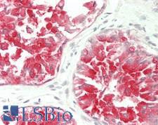 FOLH1 / PSMA Antibody - Human Prostate: Formalin-Fixed, Paraffin-Embedded (FFPE)