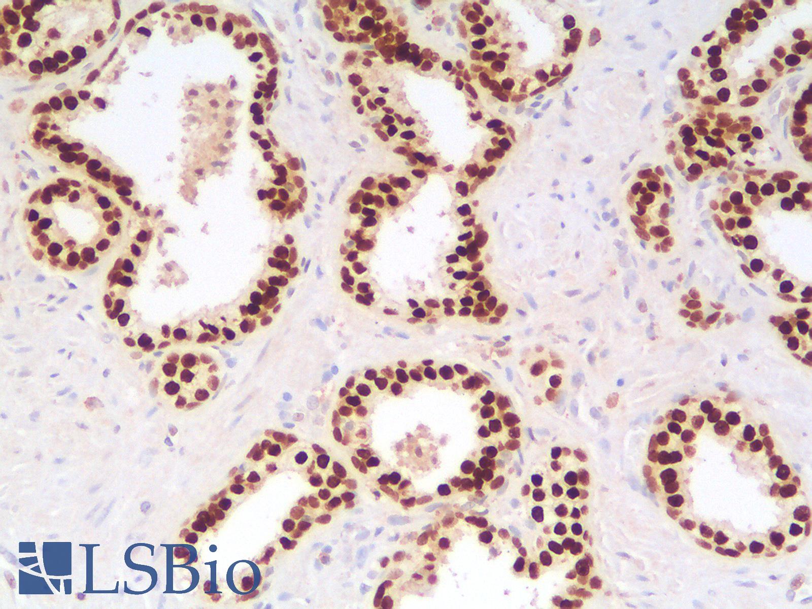 FOXA1 Antibody - Human Prostate: Formalin-Fixed, Paraffin-Embedded (FFPE)