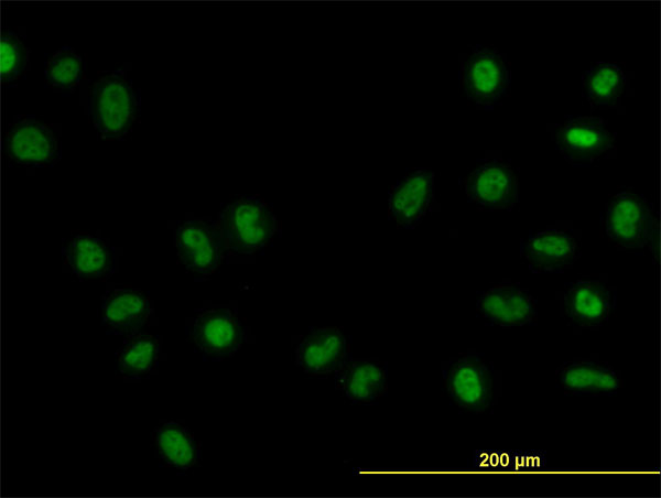 FOXA1 Antibody - Immunofluorescence of monoclonal antibody to FOXA1 on HeLa cell. [antibody concentration 10 ug/ml]