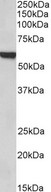 FOXA2 Antibody - FOXA2 / HNF3B antibody (1µg/ml) staining of Rat Lung lysate (35µg protein in RIPA buffer). Detected by chemiluminescence.