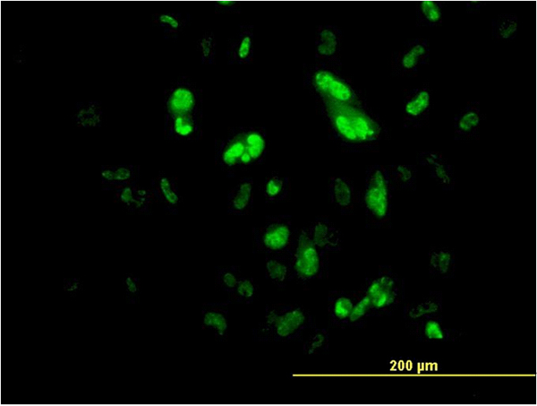FOXA2 Antibody - Immunofluorescence of monoclonal antibody to FOXA2 on HepG2 cell. [antibody concentration 10 ug/ml]