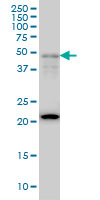 FOXA2 Antibody - FOXA2 monoclonal antibody clone 2F12 Western blot of FOXA2 expression in HepG2.