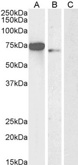 FOXC1 Antibody - FOXC1 antibody (0.3µg/ml) staining of HEK293 (A) Nuclear MCF7 (B) and Negative control Daudi (C) cell lysate (35µg protein in RIPA buffer). Detected by chemiluminescence.