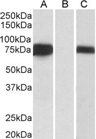 FOXC1 Antibody - FOXC1 antibody (0.5µg/ml) staining of transfected HEK293 transiently expressing full-length Human FOXC1 (myc and DYKDDDDK tagged). Detected by chemiluminescence.