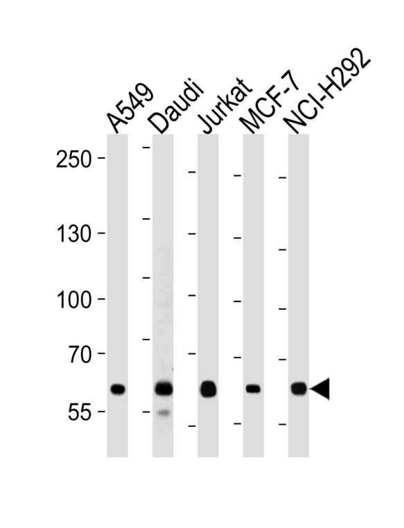 FOXP1 Antibody - FOXP1 Antibody western blot of A549,Daudi,Jurkat,MCF-7,NCI-H292 cell line lysates (35 ug/lane). The FOXP1 antibody detected the FOXP1 protein (arrow).