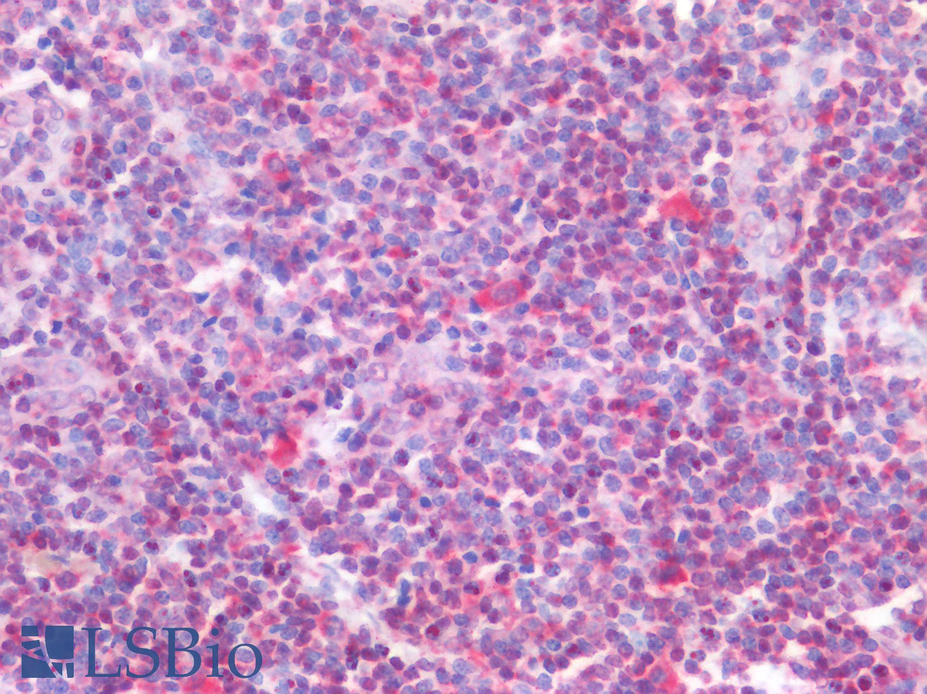 FOXP1 Antibody - Human Tonsil: Formalin-Fixed, Paraffin-Embedded (FFPE)