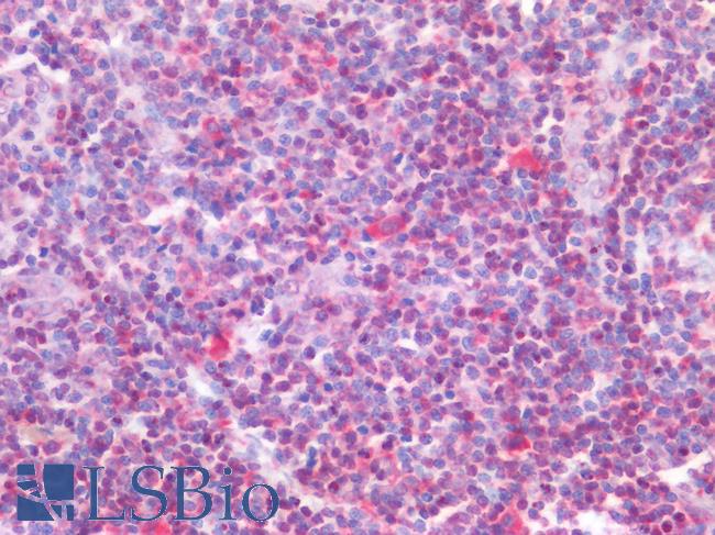 FOXP1 Antibody - Human Tonsil: Formalin-Fixed, Paraffin-Embedded (FFPE)