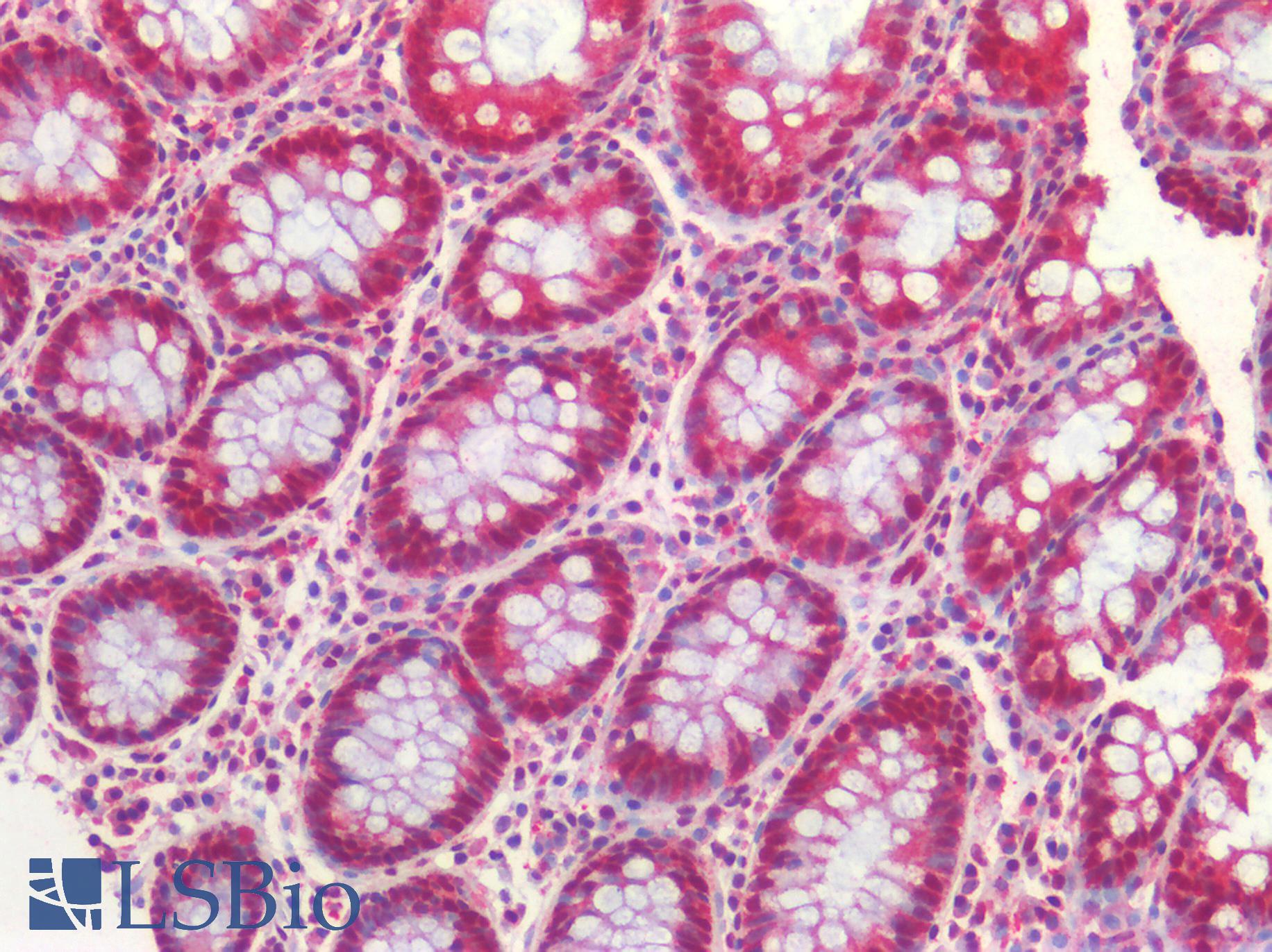 FOXP1 Antibody - Human Colon: Formalin-Fixed, Paraffin-Embedded (FFPE)