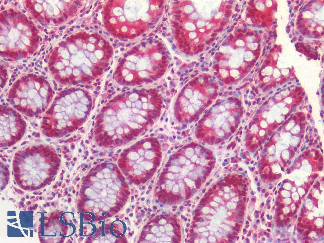 FOXP1 Antibody - Human Colon: Formalin-Fixed, Paraffin-Embedded (FFPE)
