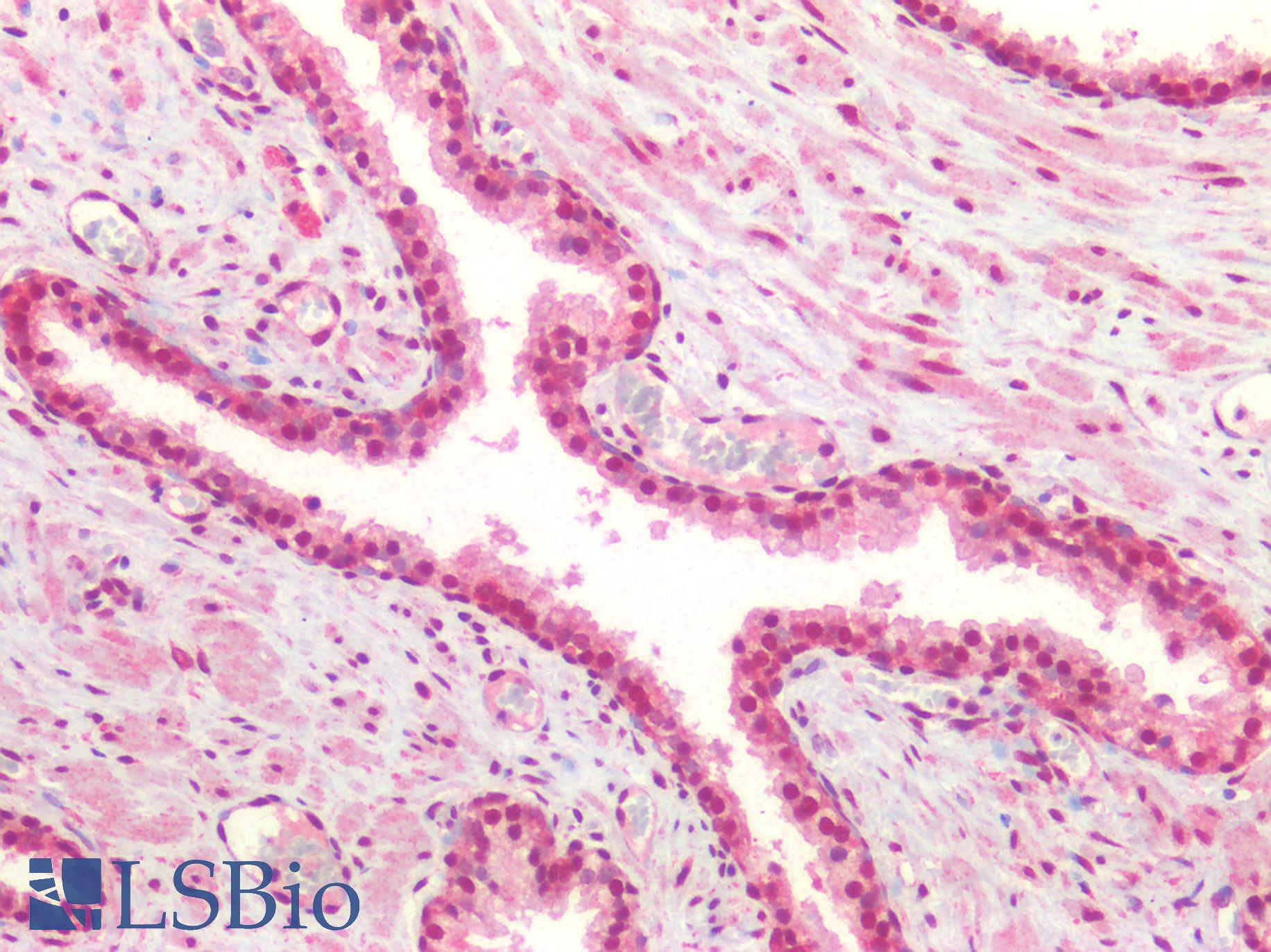 FOXP1 Antibody - Human Prostate: Formalin-Fixed, Paraffin-Embedded (FFPE)
