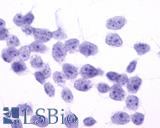 FP / PTGFR Antibody - Anti-PTGFR antibody immunocytochemistry (ICC) staining of untransfected HEK293 human embryonic kidney cells.