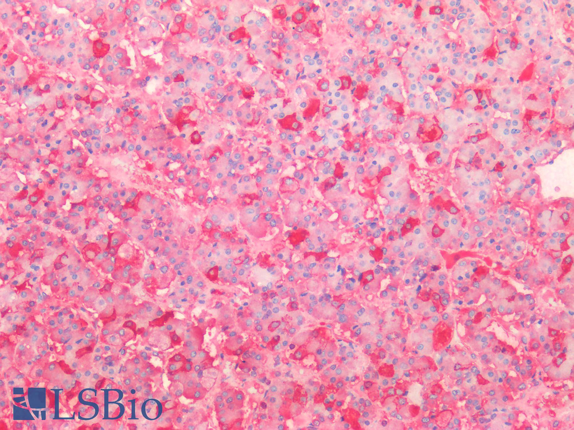 FSH Antibody - Human Pituitary: Formalin-Fixed, Paraffin-Embedded (FFPE)