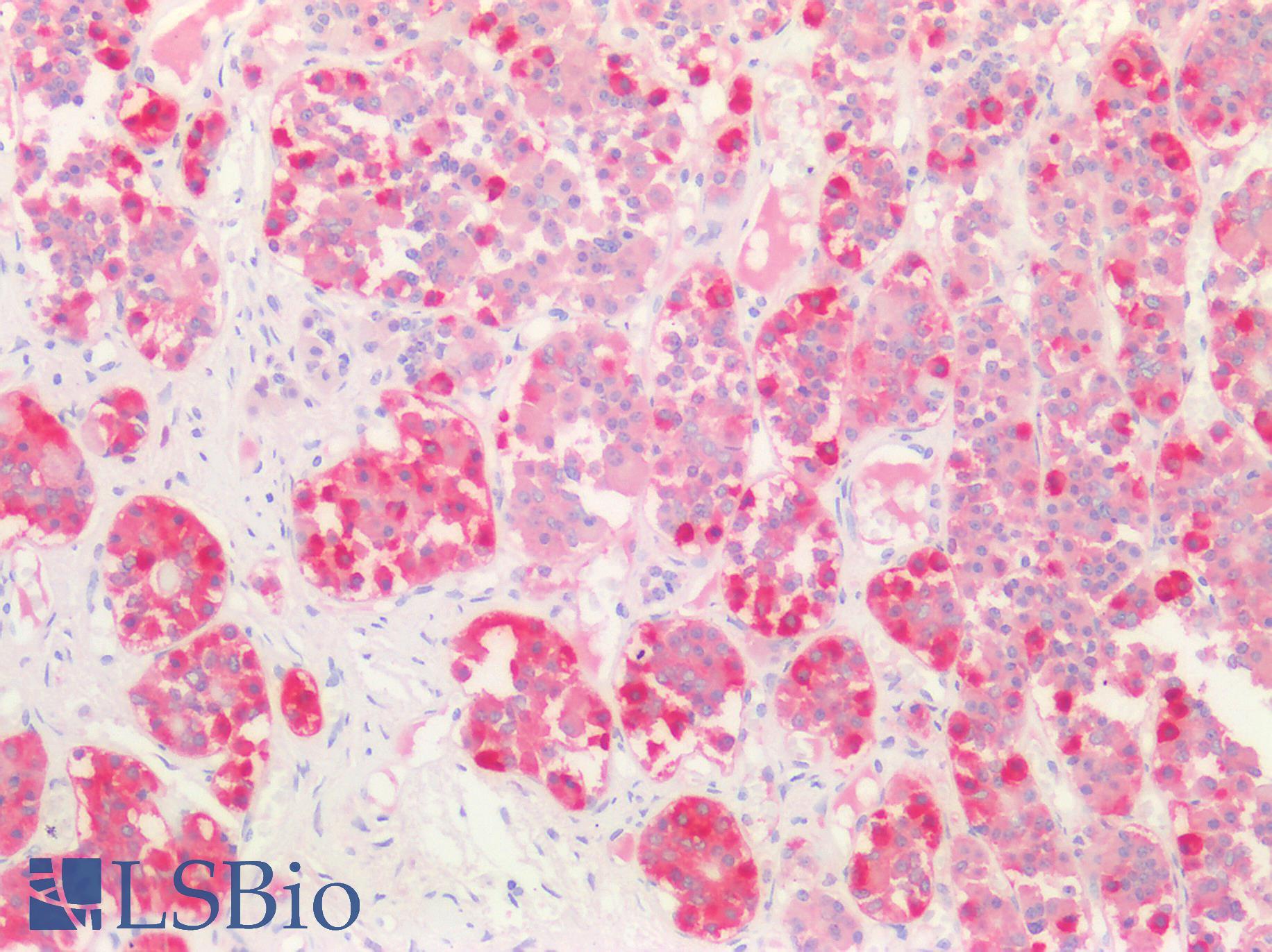 FSHB / FSH Beta Antibody - Human Pituitary: Formalin-Fixed, Paraffin-Embedded (FFPE)