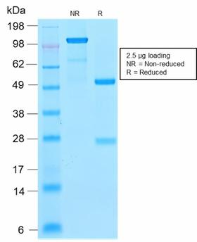 FTL / Ferritin Light Chain Antibody - SDS-PAGE Analysis Purified Ferritin LC Rabbit Recombinant Monoclonal Antibody (FTL/2338R). Confirmation of Purity and Integrity of Antibody.