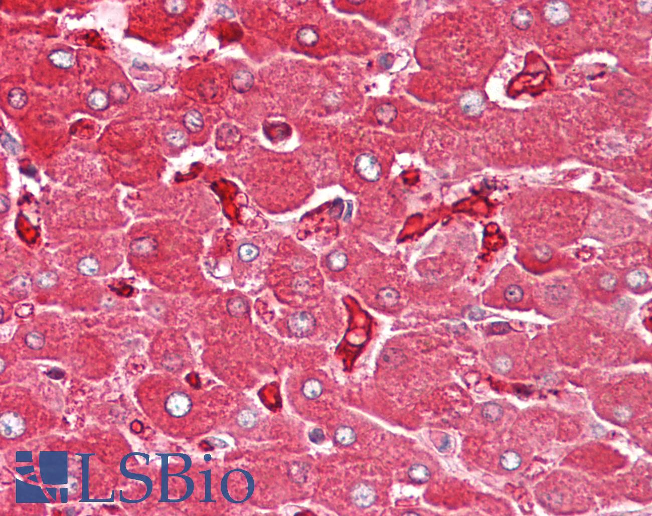 FTL / Ferritin Light Chain Antibody - Anti-FTL / Ferritin Light Chain antibody IHC of human liver. Immunohistochemistry of formalin-fixed, paraffin-embedded tissue after heat-induced antigen retrieval. Antibody dilution 5-7.5 ug/ml.  This image was taken for the unconjugated form of this product. Other forms have not been tested.