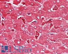 FTL / Ferritin Light Chain Antibody - Anti-FTL / Ferritin Light Chain antibody IHC of human liver. Immunohistochemistry of formalin-fixed, paraffin-embedded tissue after heat-induced antigen retrieval. Antibody dilution 5-7.5 ug/ml.  This image was taken for the unconjugated form of this product. Other forms have not been tested.