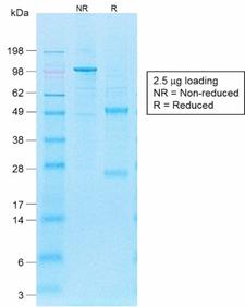 FUT4 / CD15 Antibody - SDS-PAGE Analysis of Purified CD15 Rabbit Recombinant Monoclonal Antibody (FUT4/1478R). Confirmation of Purity and Integrity of Antibody.