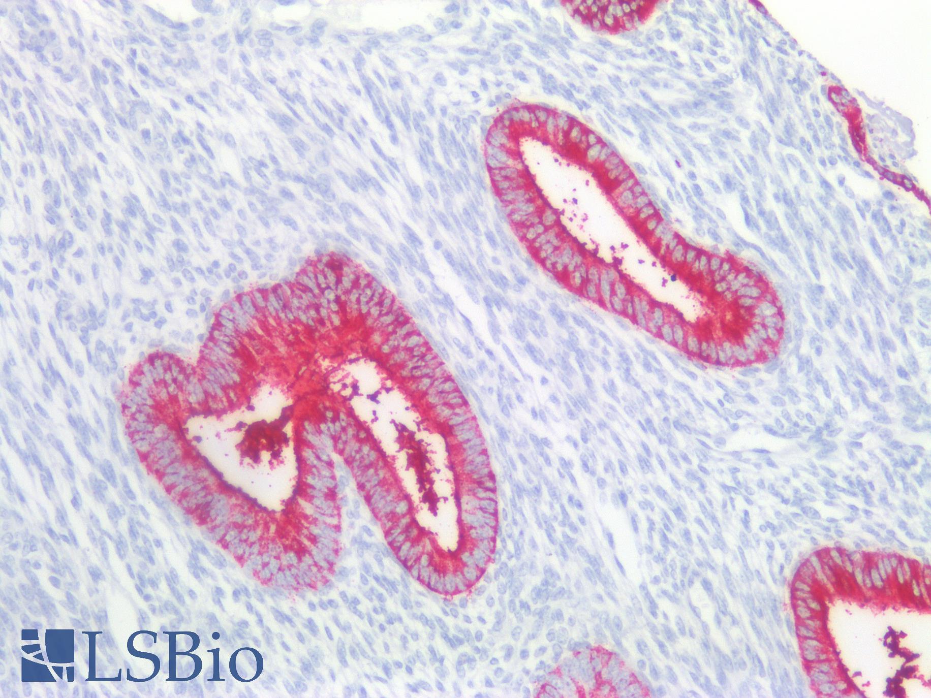 FUT4 / CD15 Antibody - Human Uterus: Formalin-Fixed, Paraffin-Embedded (FFPE)