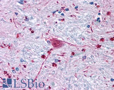 FZD3 / Frizzled 3 Antibody - Anti-FZD3 / Frizzled 3 antibody IHC of human brain, neurons and glia. Immunohistochemistry of formalin-fixed, paraffin-embedded tissue after heat-induced antigen retrieval.