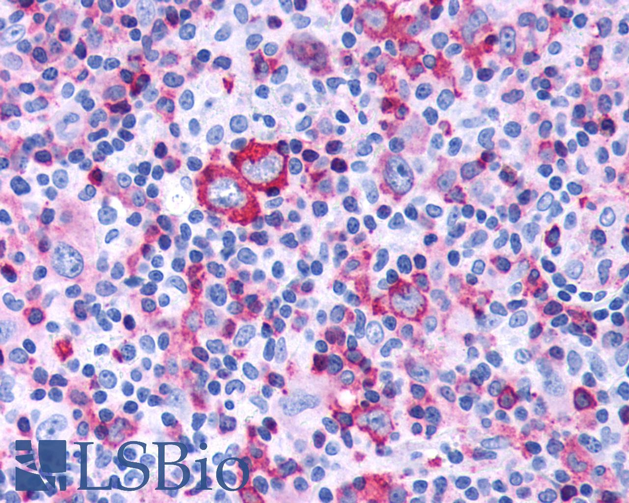 FZD4 / Frizzled 4 Antibody - Hodgkin's lymphoma