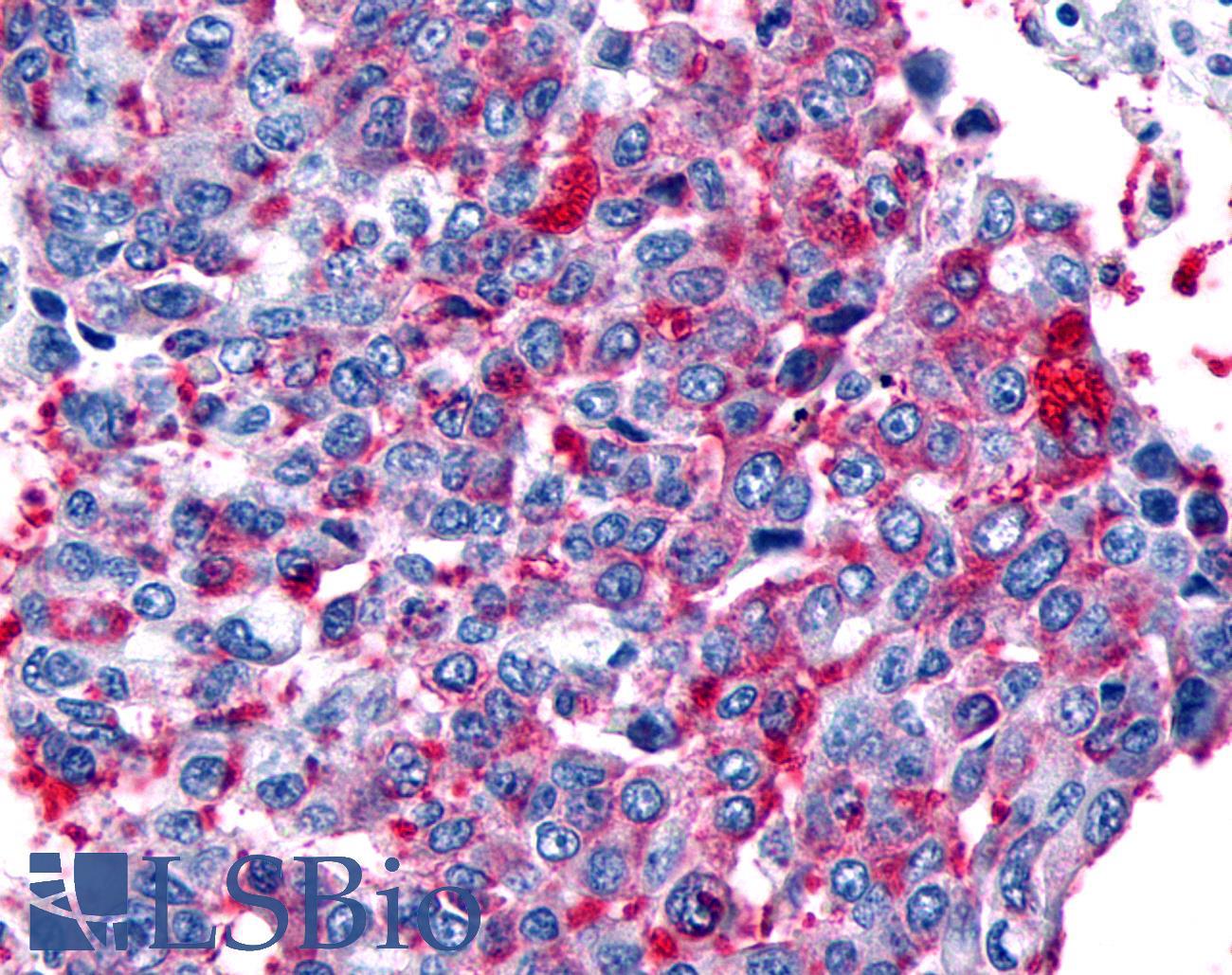 FZD8 / Frizzled 8 Antibody - Lung, non small-cell carcinoma