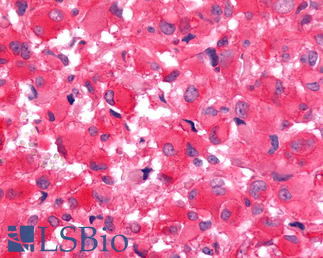 FZD9 / Frizzled 9 Antibody - Brain, Glioblastoma