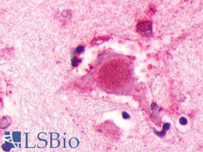 GALR3 / Galanin Receptor 3 Antibody - Brain, Alzheimer's disease neurofibrillary tangle