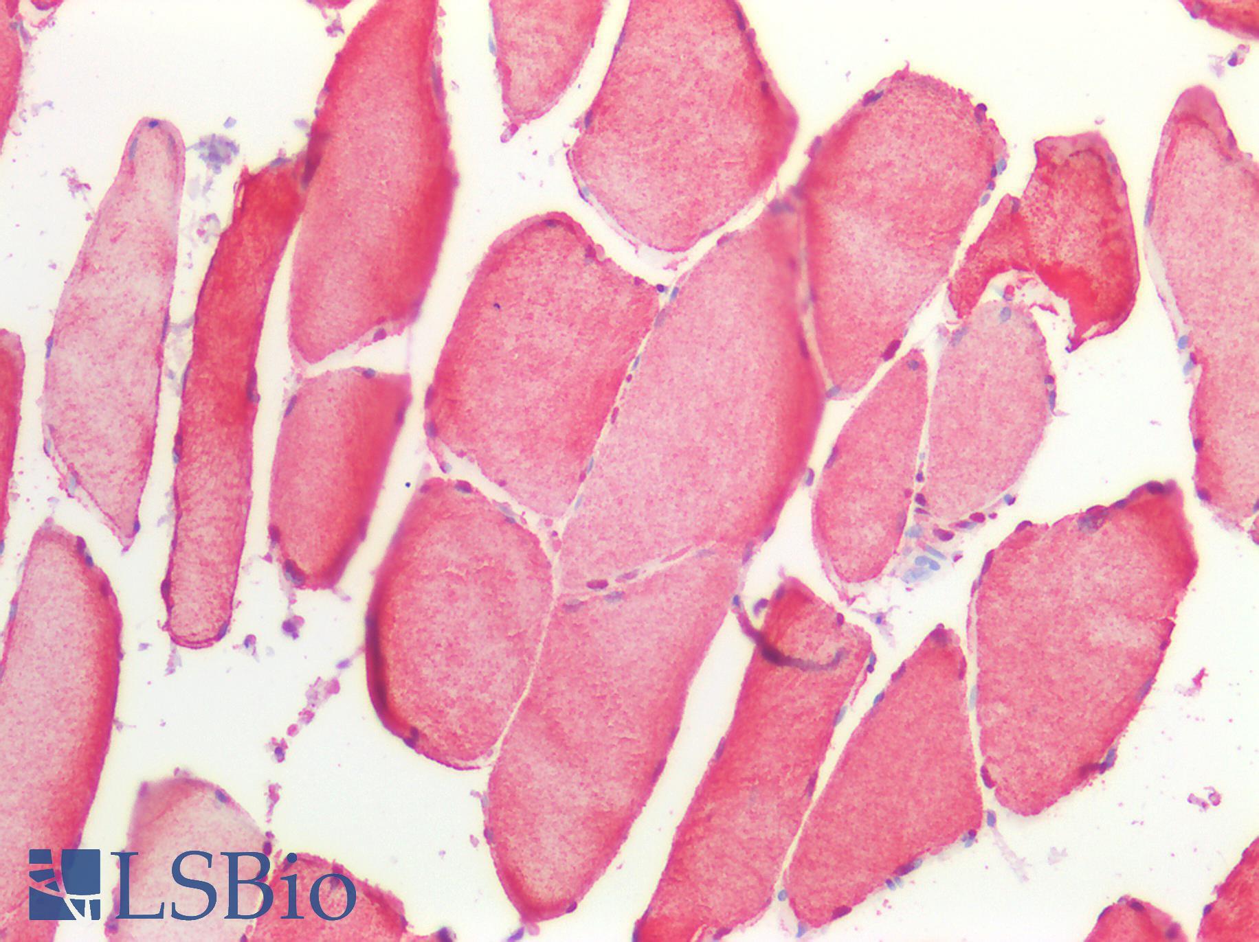 GAPDH Antibody - Human Skeletal Muscle: Formalin-Fixed, Paraffin-Embedded (FFPE)